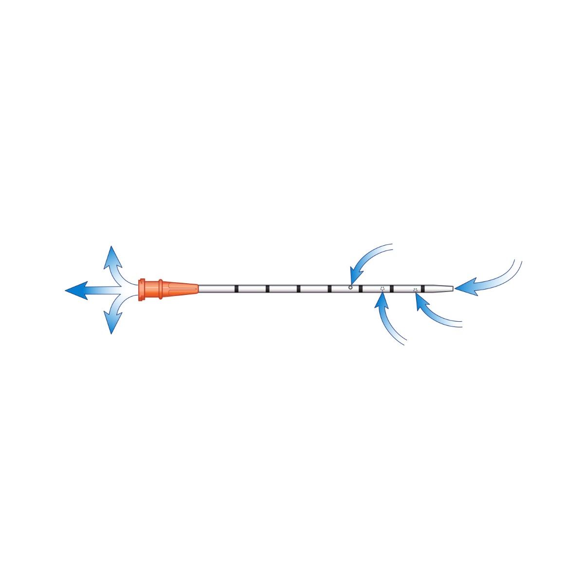 North American Rescue Enhanced ARS For Needle Decompression (14 gauge x 3.25in.)